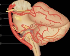 脑血管图 椎 基底动脉系图片