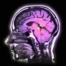 科学技术与医疗科学技术医疗大脑图层医疗图片